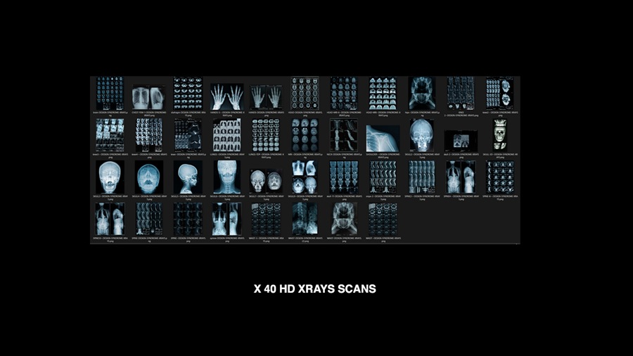 Design Syndrome 40张数字艺术X射线医学图像纹理 X-Rays Image Pack , 第2张