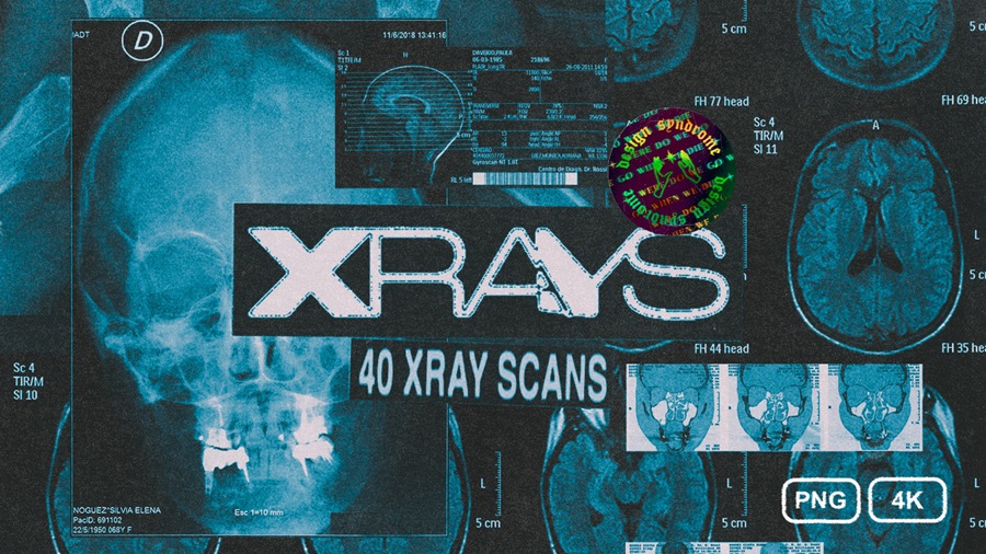Design Syndrome 40张数字艺术X射线医学图像纹理 X-Rays Image Pack , 第1张