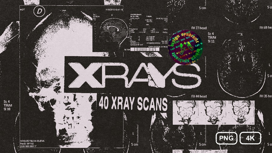 Design Syndrome 40张数字艺术X射线医学图像纹理 X-Rays Image Pack , 第3张