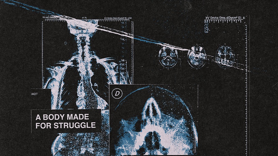 Design Syndrome 40张数字艺术X射线医学图像纹理 X-Rays Image Pack , 第4张
