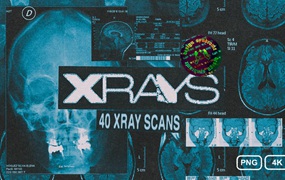 Design Syndrome 40张数字艺术X射线医学图像纹理 X-Rays Image Pack